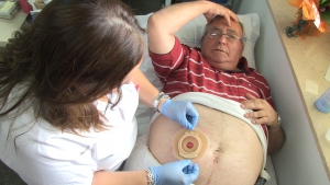 El CGE recuerda la importancia de la enfermera estomaterapeuta para los pacientes ostomizados