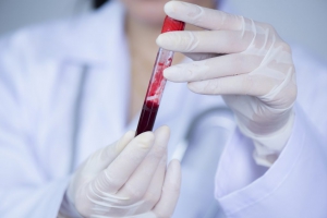 El 10% de los sanitarios españoles han desarrollado anticuerpos de Covid-19