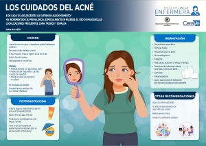 El Consejo General de Enfermería lanza un vídeo y una infografía con las claves para el cuidado del acné