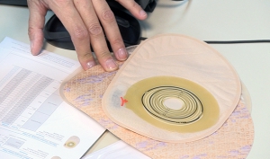 Las enfermeras estomaterapeutas garantizan la autonomía y la calidad de vida de las personas ostomizadas