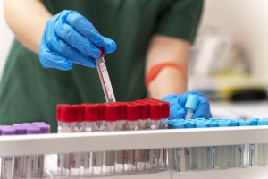 Nueva edici&oacute;n de la Gu&iacute;a de Pr&aacute;ctica Cl&iacute;nica Enfermera sobre Hemocultivos